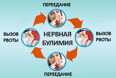 Лечение булимии в Бирске